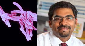 TB Diagnostics Resources Available via Cal Alum
