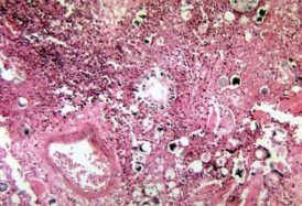 CEND Investigator Justin Remais’ lab tackles Valley Fever